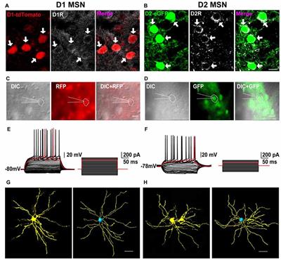 Striatal Distribution and Cytoarchitecture of Dopamine Receptor Subtype 1 and 2: Evidence from Double-Labeling Transgenic Mice